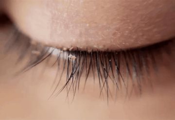 Alertan sobre aparición de piojos por uso de pestañas postizas