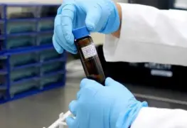 En observación dos posibles casos de coronavirus en el Estado de México