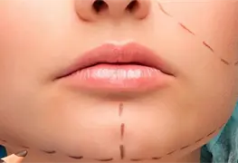 Rifar&aacute;n cirug&iacute;a est&eacute;tica por el D&iacute;a Internacional de la Mujer