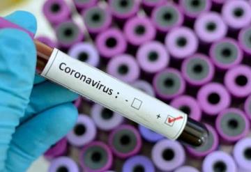 Cuenta María del Pilar, primer caso de coronavirus en Tabasco, su experiencia con la enfermedad