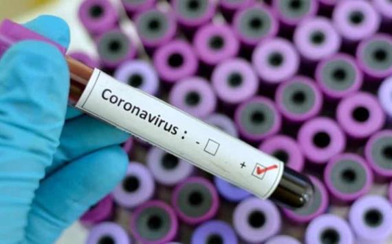 Cuenta María del Pilar, primer caso de coronavirus en Tabasco, su experiencia con la enfermedad