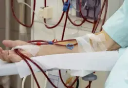 Hemodializados, sector más vulnerable ante Covid-19