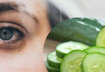 ¿Tienes ojeras? una mascarilla de papa y pepino es la solución
