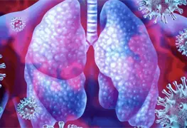 Se acerca la temporada de influenza, as&iacute; puedes diferenciarla de Covid-19