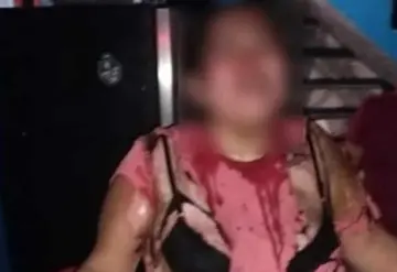 Hombre rocío con alcohol a su esposa y le prendió fuego, hechos ocurridos en Gaviotas Norte