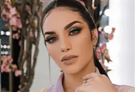 As&iacute; luc&iacute;a el rostro de Kimberly Loaiza antes de operarse 