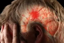 Joven se causa un derrame cerebral por estirar el cuello