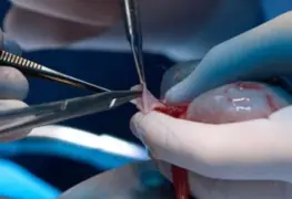 IMSS realiza trasplantes para 11 pacientes en menos de 24 horas