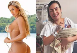 Modelo de Brasil revela dificultades para amamantar por el exceso de cirugías