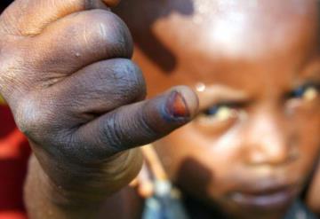 Reaparece en África virus salvaje de polio, países se encuentran en peligro