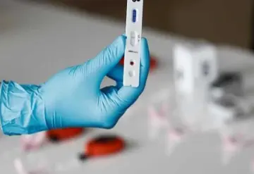 Tabasco suma 161 nuevos casos de covid-19