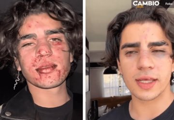 Golpean a influencer en antro de Querétaro por botella de 10 mil pesos