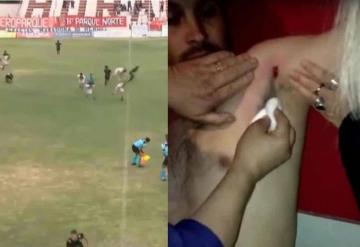 Reportan tiroteo por juego de futbol en Argentina