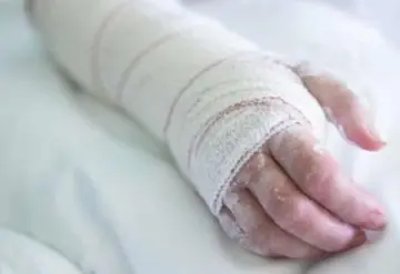 En Jalisco un sujeto prende fuego a mujer en situación de calle tras intentar abusar de ella