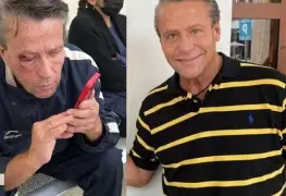 Alfredo Adame es golpeado afuera de su casa; tiene posible desprendimiento de retina