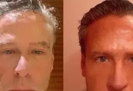 Golpean a Alfredo Adame afuera de su casa; asegura que no puede ver de un ojo