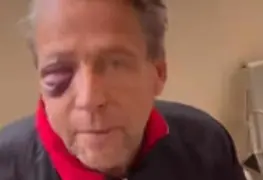 Alfredo Adame confirma que necesita cirugía por fracturas tras brutal golpiza