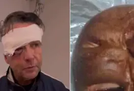 ´Chale, se pasan banda´, dijo Alfredo Adame del pan de su cara deformada por una golpiza