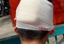 Denuncian agresión contra menor de edad en secundaria; le clavan un desarmador en la cabeza