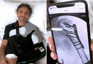 Por accidente Eugenio Derbez no volvería a levantar su brazo derecho