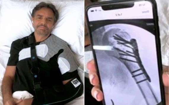 Por accidente Eugenio Derbez no volvería a levantar su brazo derecho