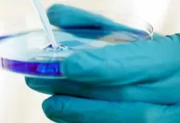 Reportan a la primera mujer curada de VIH gracias a células madre de cordón umbilical