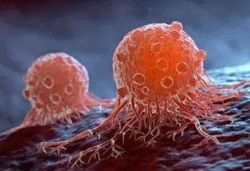 La probabilidad del cáncer aumenta casi un 80 % en tres décadas entre los menores de 50 años
