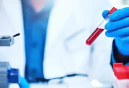 ¿Qué grupo sanguíneo tiene más probabilidad de padecer Alzheimer?