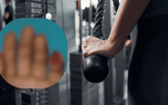 Mujer pierde dedo en una pelea con otra usuaria en gimnasio de Monterrey