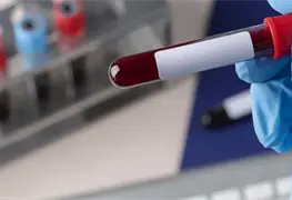 Sangre con VIH afect&oacute; a 30 mil pacientes en Reino Unido