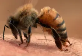 Picaduras de abeja: Desde molestias comunes hasta emergencias médicas
