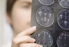 Enfermedades neurológicas en Latinoamérica, sin buen diagnóstico ni tratamiento adecuado