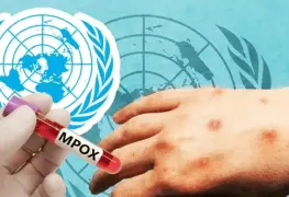 OMS declara a la viruela del mono, mpox, como emergencia mundial de salud