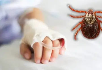 Dos menores mueren por rickettsiosis, picadura de garrapata en Nuevo León