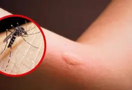 Suman 101 muertes por dengue en México