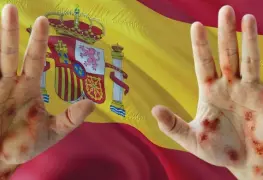 Urgen más controles sanitarios tras el primer caso de mpox en Europa