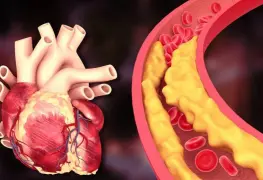 ¿Qué tan malas son las grasas?