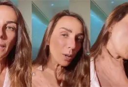 Consuelo Duval fue operada de emergencia tras explosi&oacute;n de implante mamario