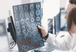 El caso más joven de alzheimer diagnosticado: es un hombre de 19 años en China