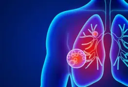 Neumonía, el Asesino Olvidado de Niños y Mayores