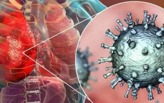 Se registra dos casos de Metapneumovirus en México.