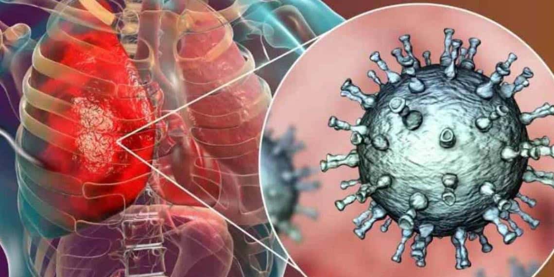 Se registra dos casos de Metapneumovirus en México.