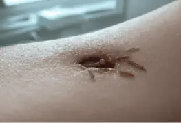 Detectan nueva infección por gusano barrenador