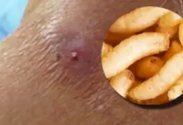 Alerta sanitaria en Chiapas