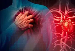 Infartos silenciosos