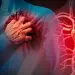 Infartos silenciosos
