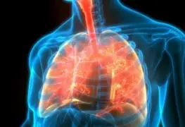 Alerta epidemiol&oacute;gica por Yersinia pestis en Coconino