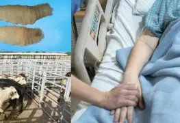 Brote de miasis por gusano barrenador afecta a M&eacute;xico