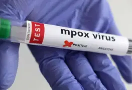 Fallece hombre de 32 años por Mpox en Jalisco