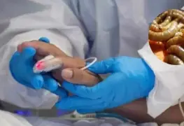 Confirman muerte por gusano barrenador en México